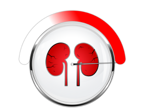 IgA nephropathy late stage icon